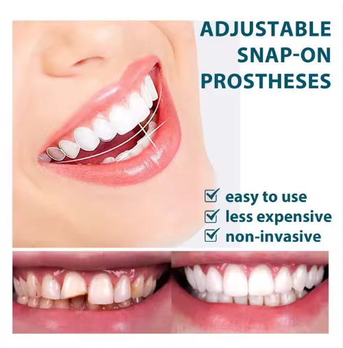 Silicone Dental Braces